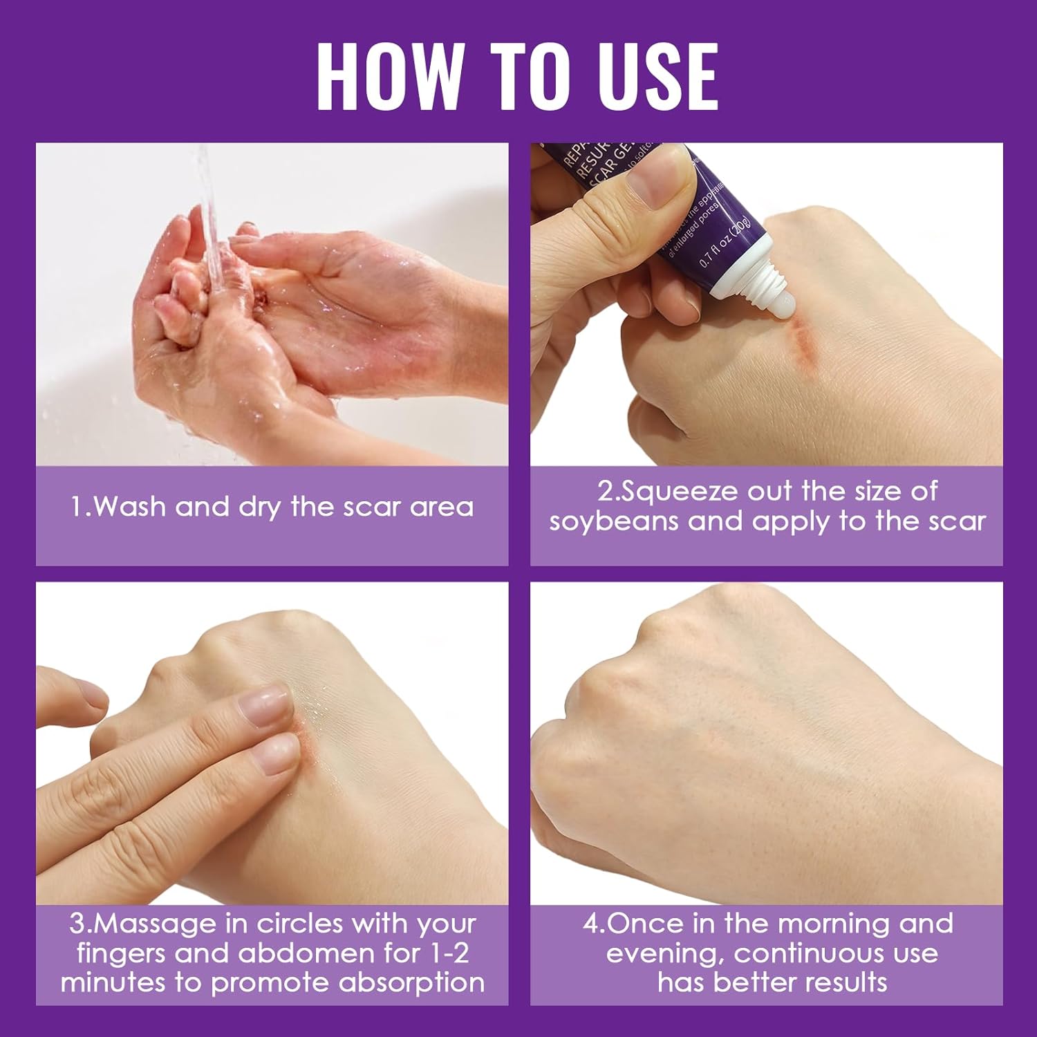 20g Crème Cicatrice, Gel De Cicatrice, Scar gel Réduire et enlever les cicatrices, Pour Cicatrices Anciennes Et Nouvelles, Absorption Rapide, Prendre soin des cicatrice, réparer la peau