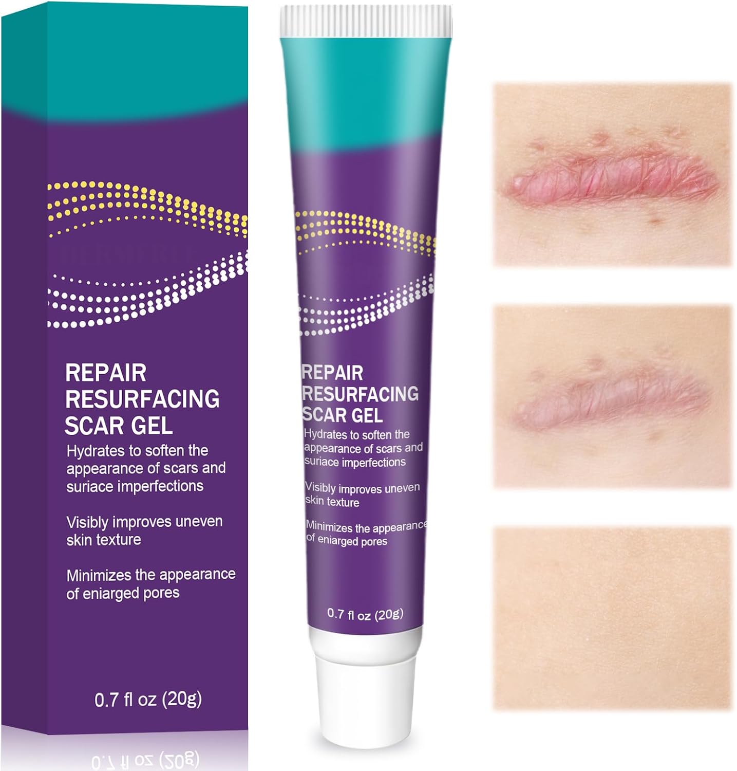 20g Crème Cicatrice, Gel De Cicatrice, Scar gel Réduire et enlever les cicatrices, Pour Cicatrices Anciennes Et Nouvelles, Absorption Rapide, Prendre soin des cicatrice, réparer la peau