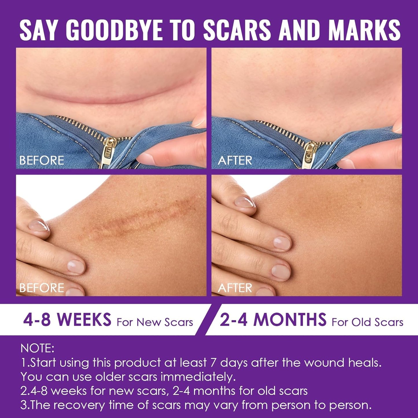 20g Crème Cicatrice, Gel De Cicatrice, Scar gel Réduire et enlever les cicatrices, Pour Cicatrices Anciennes Et Nouvelles, Absorption Rapide, Prendre soin des cicatrice, réparer la peau