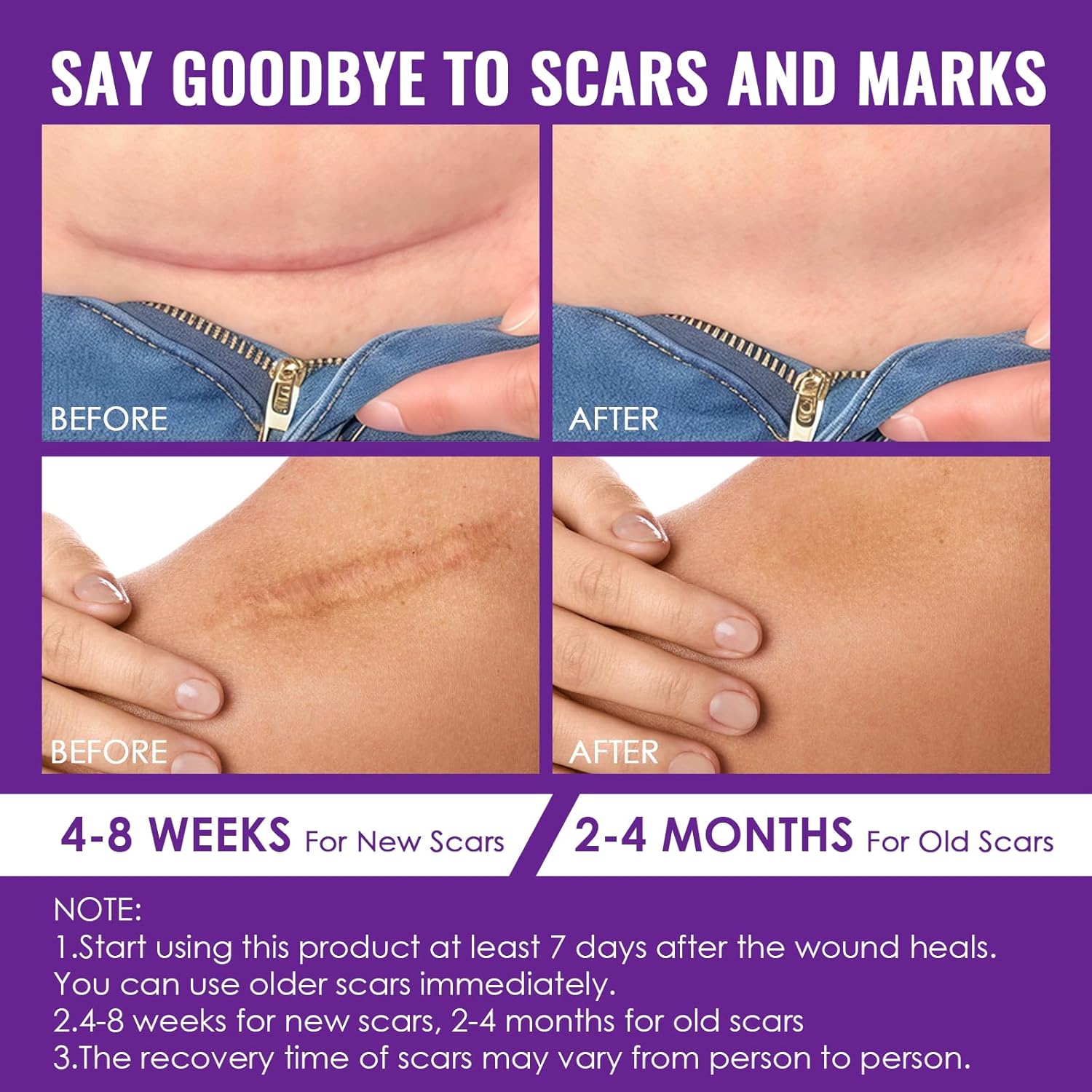 20g Crème Cicatrice, Gel De Cicatrice, Scar gel Réduire et enlever les cicatrices, Pour Cicatrices Anciennes Et Nouvelles, Absorption Rapide, Prendre soin des cicatrice, réparer la peau